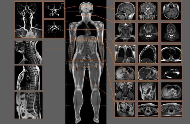 爱康核磁共振医学影像中心成立 看见"看不见"的健康